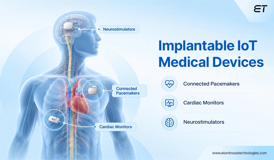 Implantable IoT Medical Devices
